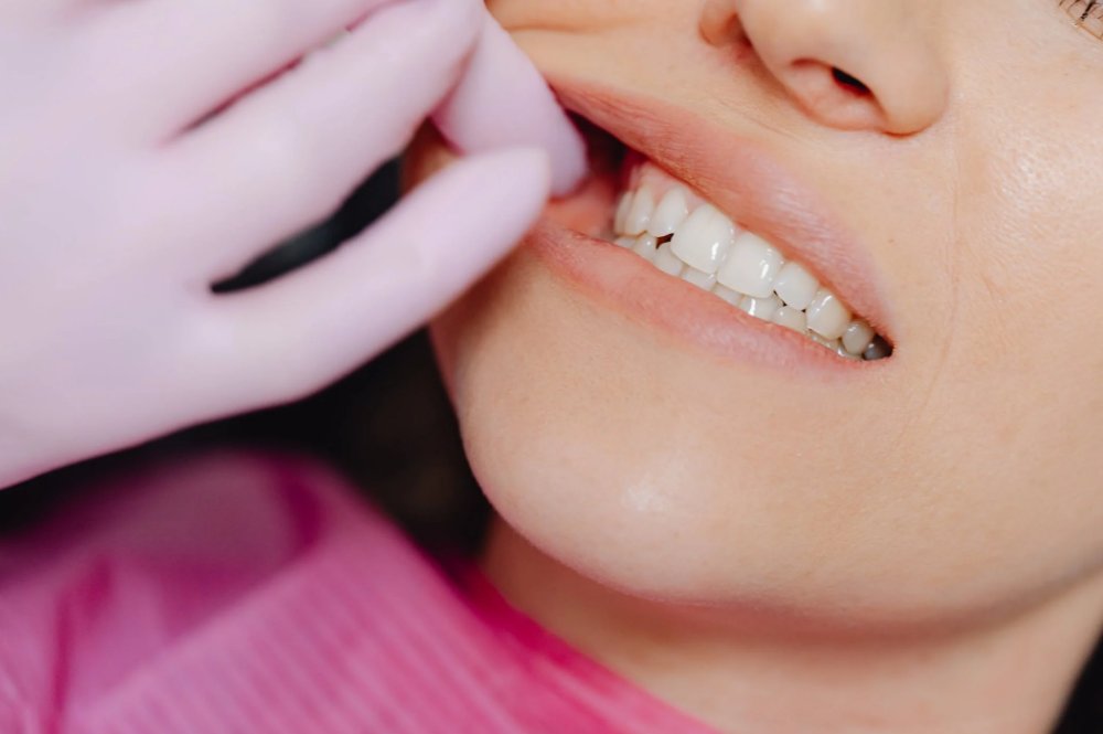 Dental Implant Cost | Dental Implants Surgeon Near Me