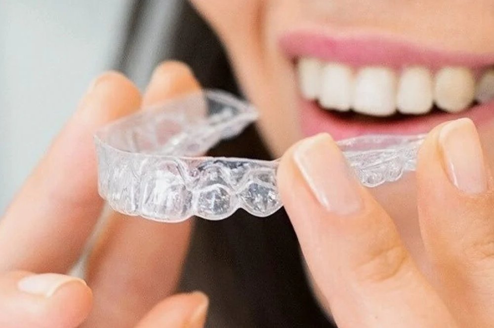 Invisalign Clear Braces | Invisalign Dentist in Castle Rock