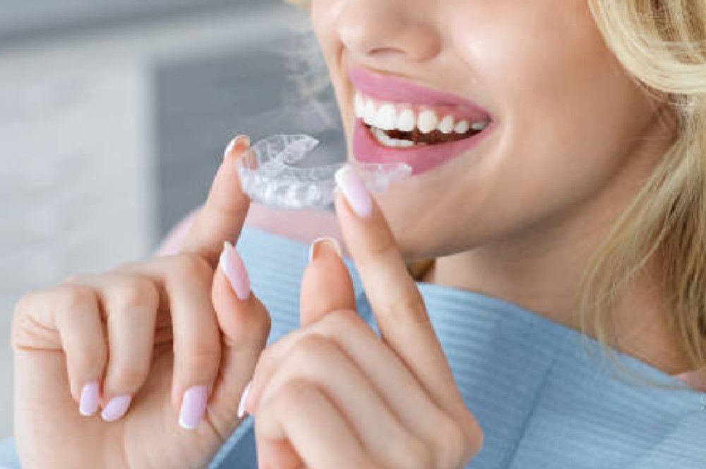 Invisalign