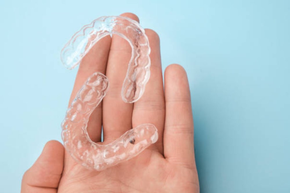 Why You Should Choose Invisalign Over Mail-Order Aligners?