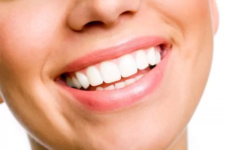 white smile